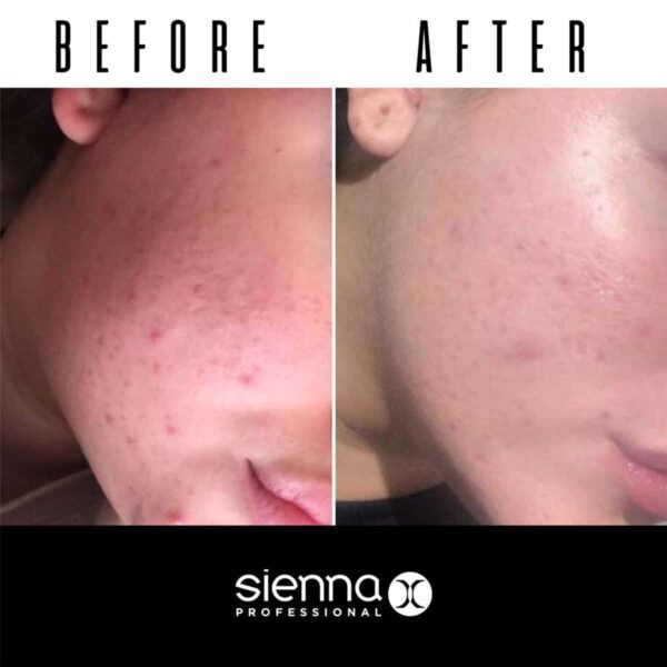 Sienna X The Retinol Serum retinolio serumas veidui 20 ml copy