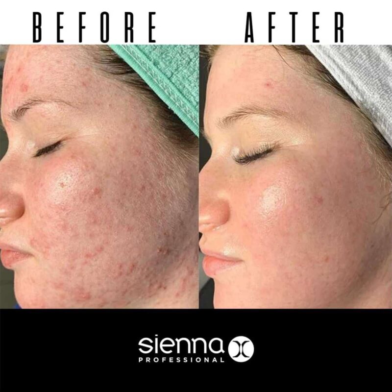 Sienna X The Clay Mask detoksikuojanti molio kaukė veidui 150 ml - Image 7